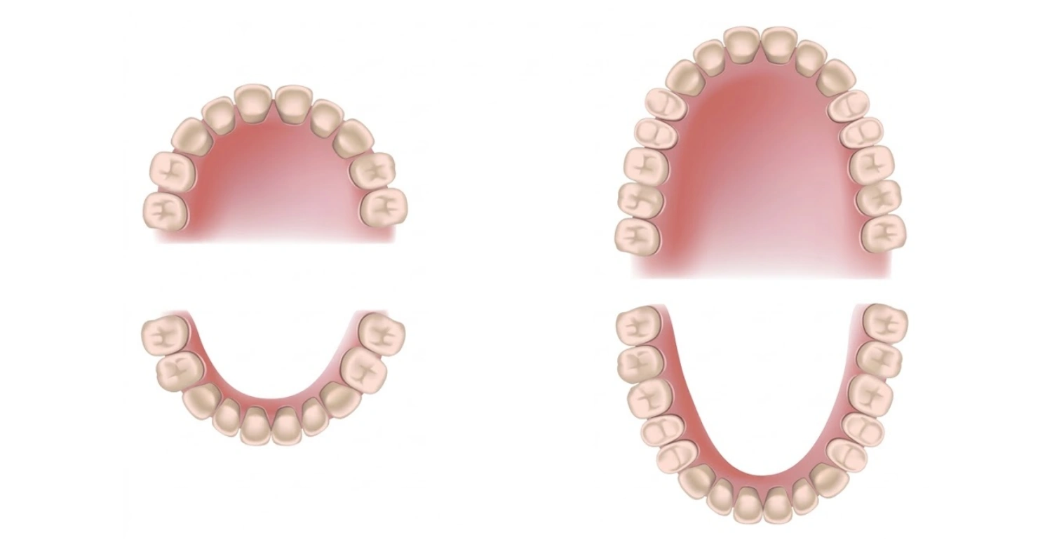 Baby Teeth vs Permanent Teeth Inblog